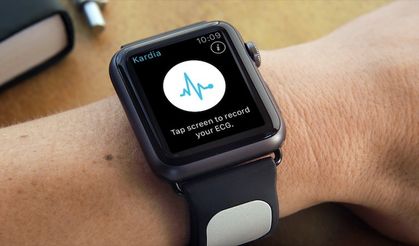 Apple Watch için AliveCor Kardiobant Onaylandı
